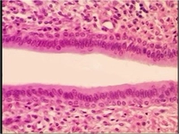 İdrarda Epitel Hücre Türleri ve Özellikleri İdrarda Epitel Hücre Türleri ve Özellikleri